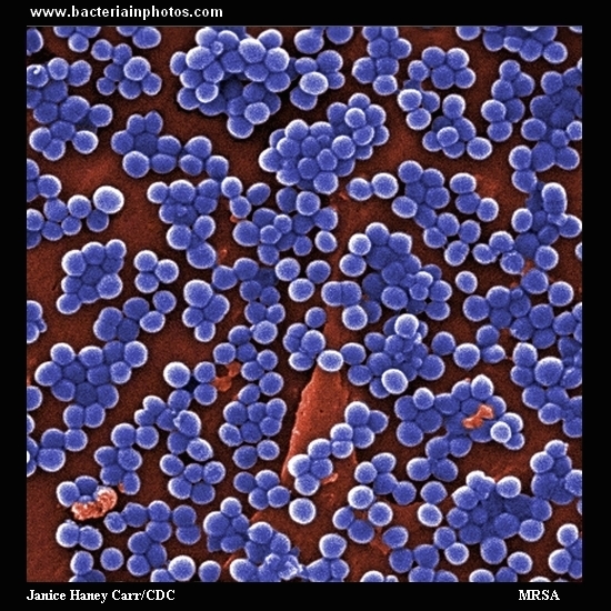Methicillin-resistant Staphylococcus aureus (MRSA) under electron microscope